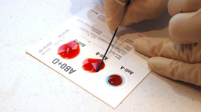 Nguyên tắc truyền máu cơ bản là gì? Các phản ứng truyền máu nguy hiểm như thế nào? 1
