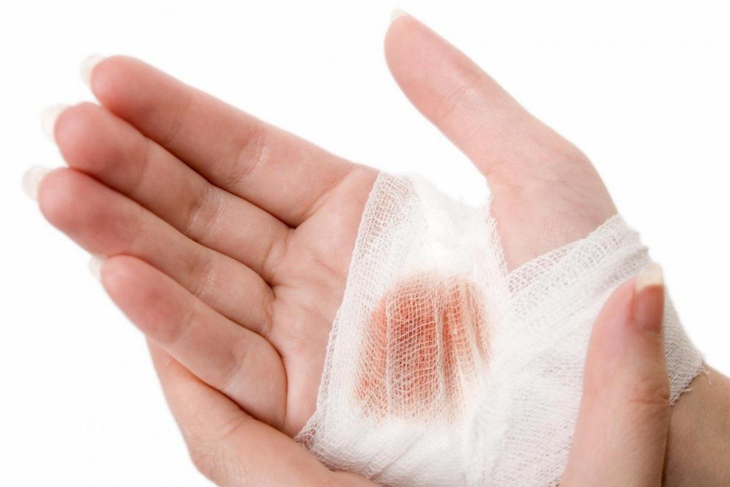 Xét nghiệm uốn ván liệu có cần thiết hay không 2
