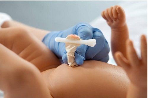 Chủ động dự phòng uốn ván rốn ở trẻ sơ sinh 3