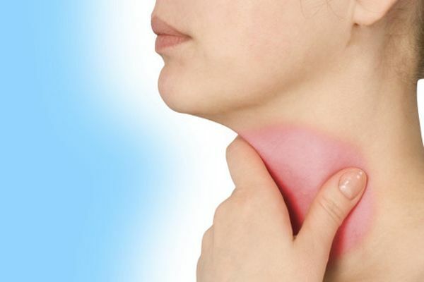 Trào ngược dạ dày gây đau họng - Bệnh phổ biến nhưng ít người biết 1