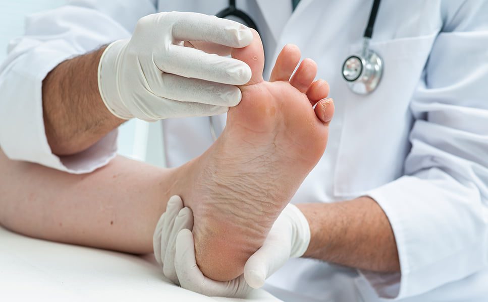 Cách nhận bệnh nấm da chân và phương pháp để đối phó với chứng bệnh này 3
