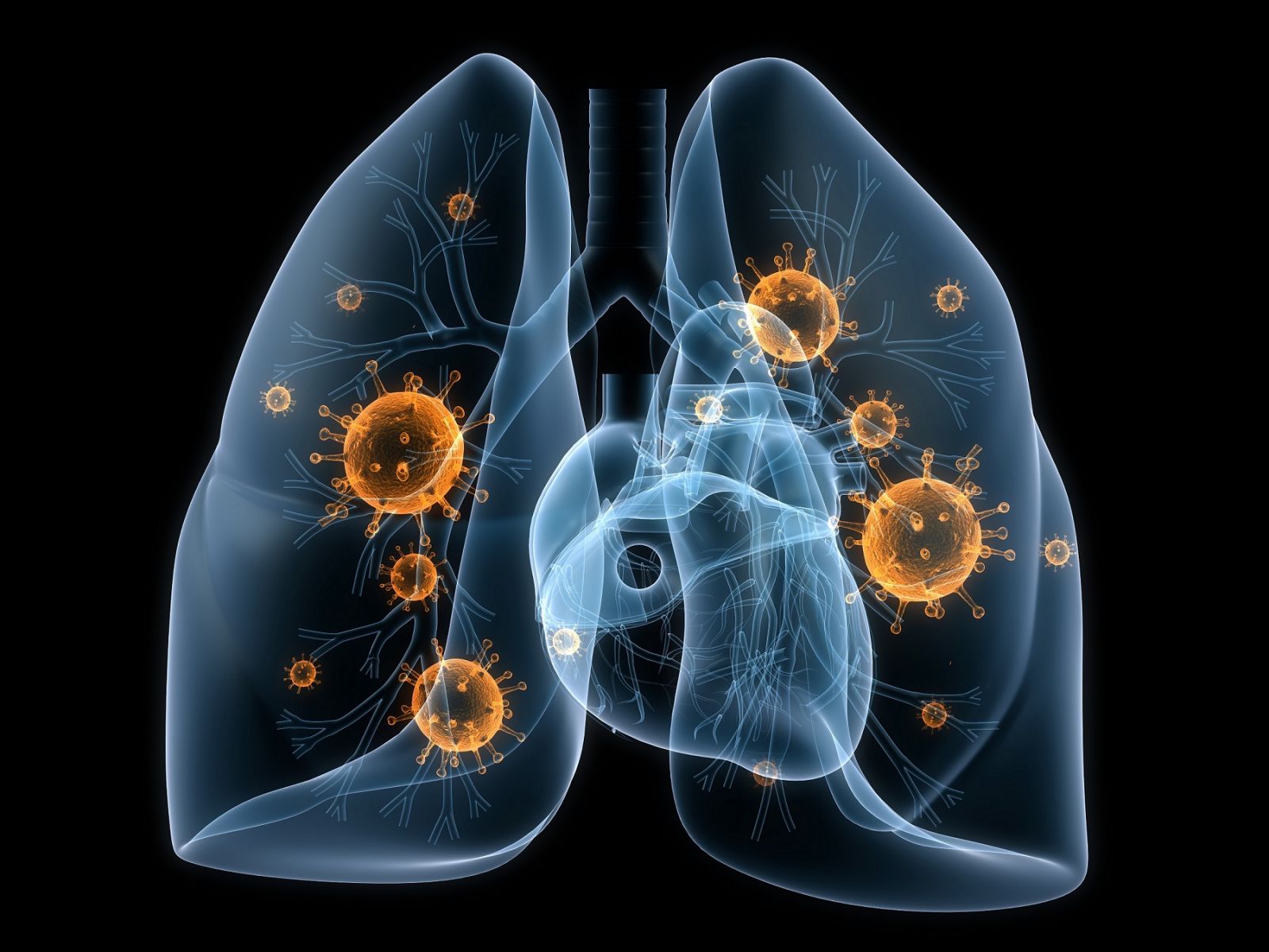 Bệnh viêm phổi cấp tính có nguy hiểm không 1