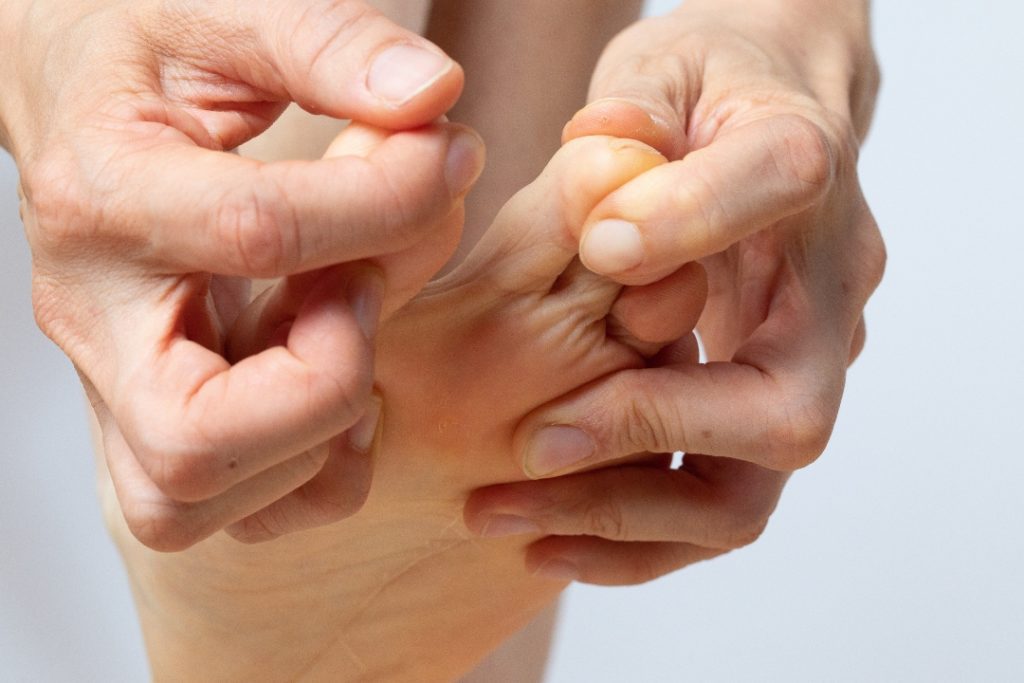 Cách nhận bệnh nấm da chân và phương pháp để đối phó với chứng bệnh này 1