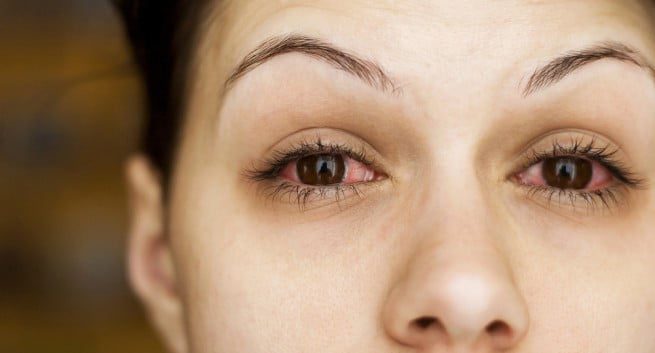 Phòng chống khô mắt hiệu quả với 6 cách đơn giản1