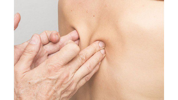 Bật mí cho bạn mẹo dân gian chữa đau thần kinh tọa cực uy tín 4