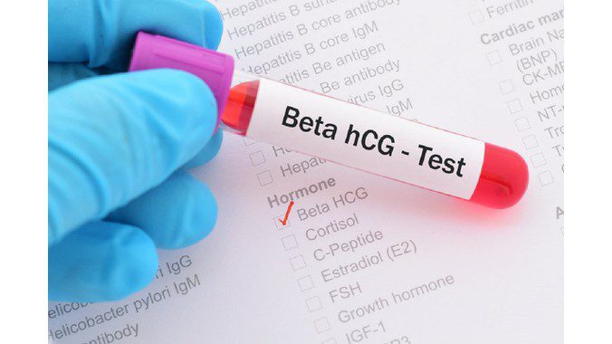 Xét nghiệm beta HCG là gì Có cần thiết không 1
