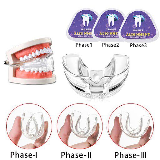 Những Chia Sẻ Về Niềng Răng Trainer A1 A2 A3