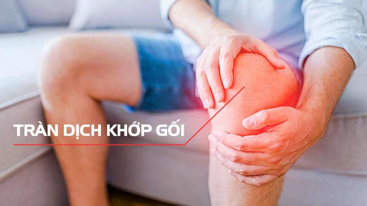 Benh ly tran dich khop goi kieng an gi