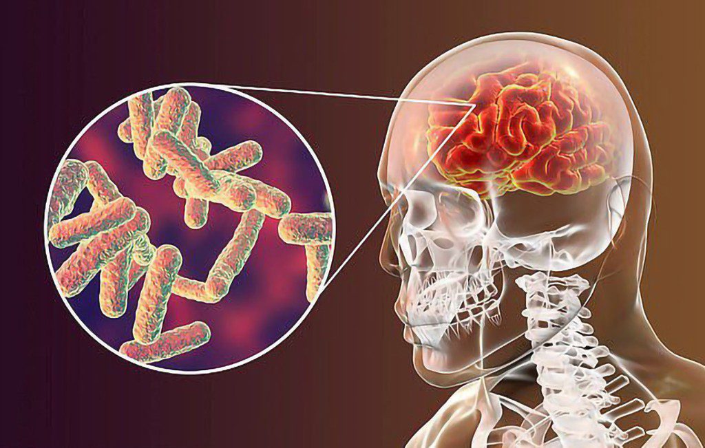Phế cầu khuẩn là gì? Những bệnh lý do phế cầu khuẩn gây ra?